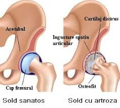 Acidul Hialuronic si Colagenul